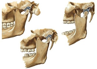 Mandíbula e Articulação Temporomandibular