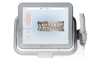Scanner intraoral iTero®