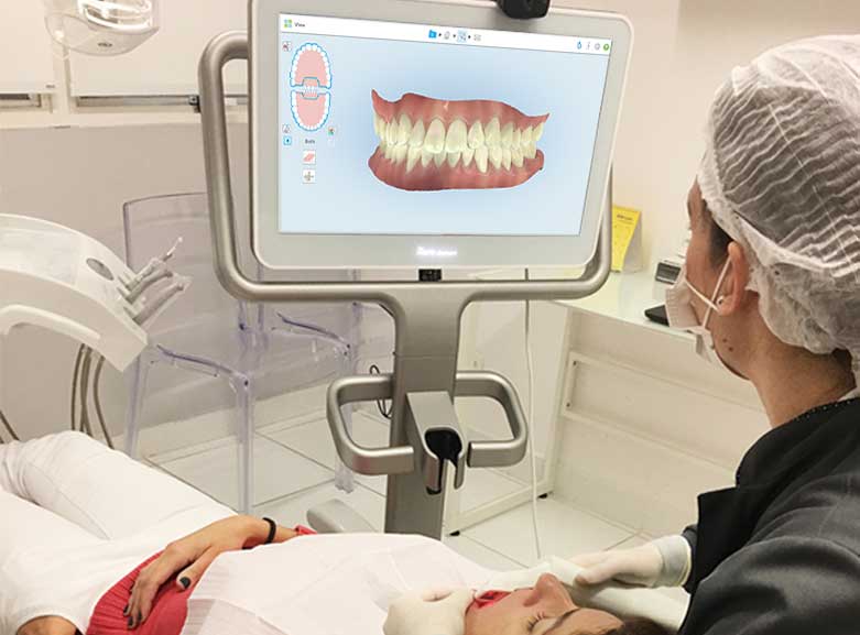 Scaneamento intraoral feito na clínica