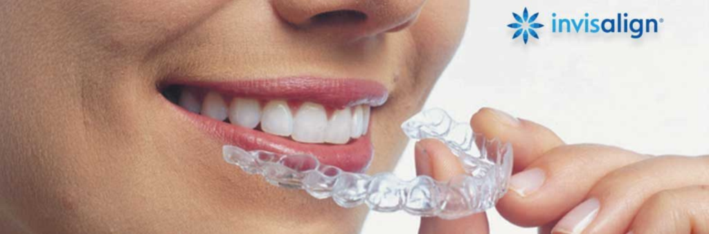 Aparelho Invisalign®- transparente, discreto e confortável