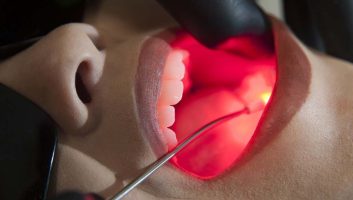 A Phile Odontologia nasceu em 2006, fruto da amizade e da dedicação de cinco dentistas formados juntos, unidos pelo amor à odontologia e pela vontade de oferecer um atendimento de excelência.